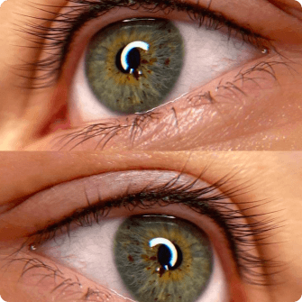 Lash Line Enhancement result 2