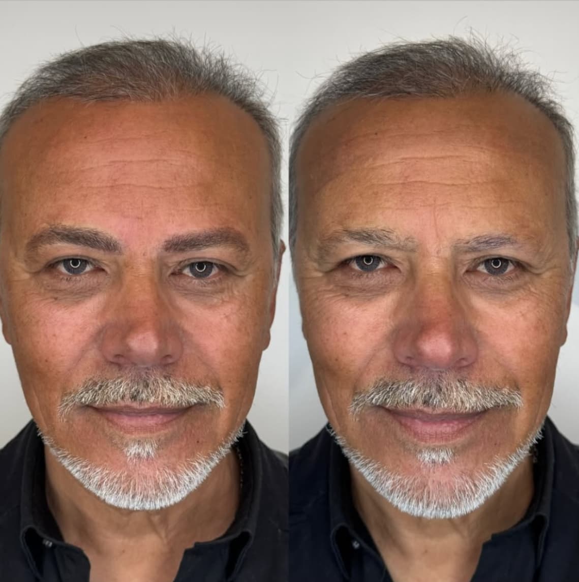 Machine Hair Strokes result 4