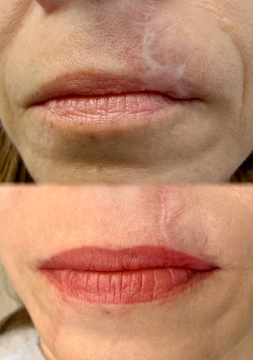 Lip Blushing result 2