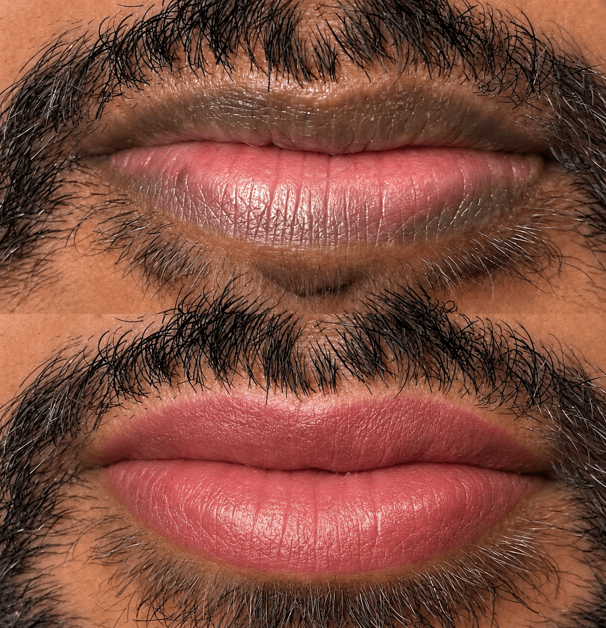 Dark Lips Neutralization result 2