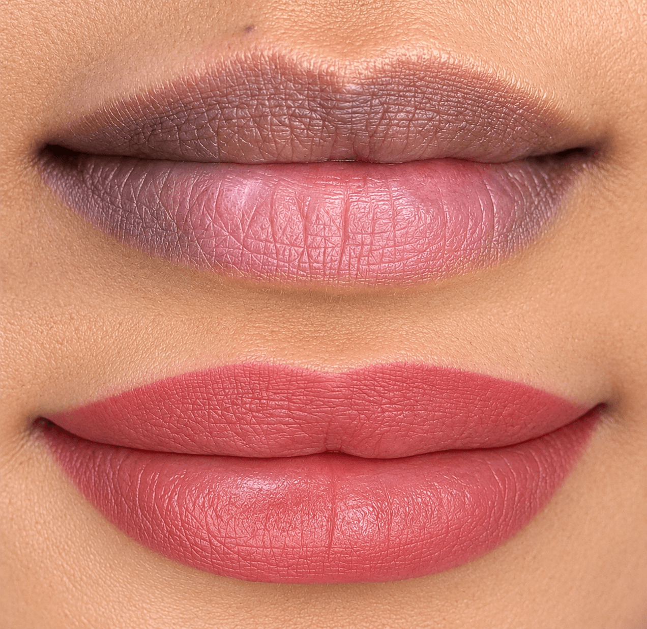 Dark Lips Neutralization result 5